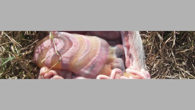 Edema de mesocolon producida por infección con E.  1