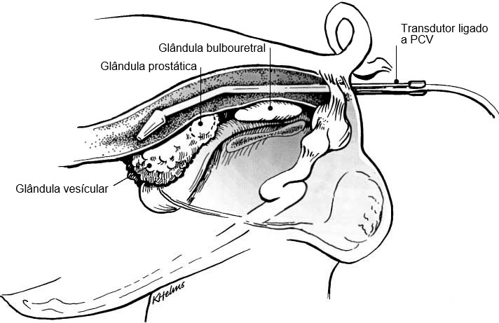 Figura 1: Coloca&ccedil;&atilde;o do suporte do transdutor com o transdutor pelo recto para visualiza&ccedil;&atilde;o de gl&acirc;ndulas sexuais acess&oacute;rias do varrasco (Clark &amp; ​​Althouse, 2002).&nbsp;
