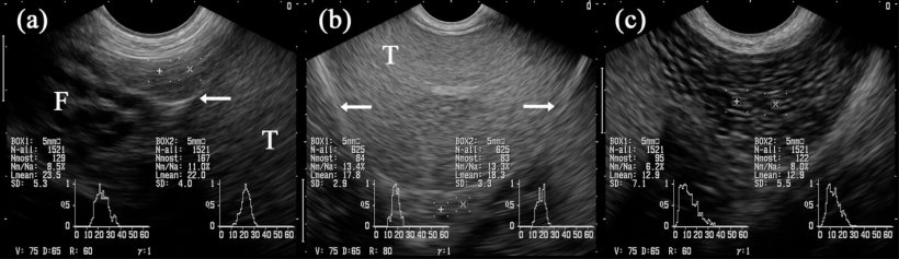 Figura 5:&nbsp;Imagens ultrasonogr&aacute;ficas dos segmentos do epid&iacute;dimo: caput (= cabeza, a), corpo (b) e cauda (= cauda; c). As caixas marcadas com &quot;+&quot; e &quot;x&quot; projectam-se nos respectivos segmentos do epid&iacute;dimo. Test&iacute;culo (T). Junto &agrave; cabe&ccedil;a h&aacute; estruturas tubulares m&uacute;ltiplas identificadas como partes do funiculus spermaticus (F). As setas indicam a cobertura testicular serosa (ou seja, bursa testicularis). (Kauffold et al., 2011)
