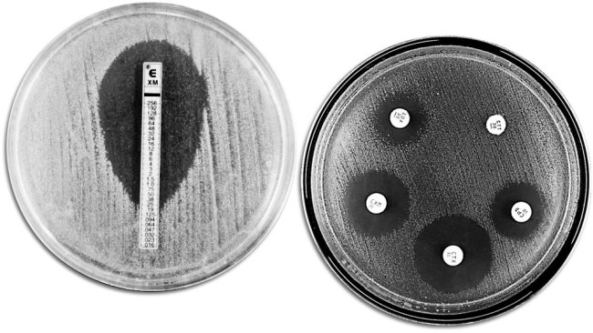 Técnicas clássicas de avaliação da resistência a antibióticos. À esquerda, E-TEST que permite medir a concentração mínima de antibiótico que impede o crescimento bacteriano. À direita, um antibiograma em que são observados diferentes auréolas de inibição do crescimento por parte dos antibióticos.
