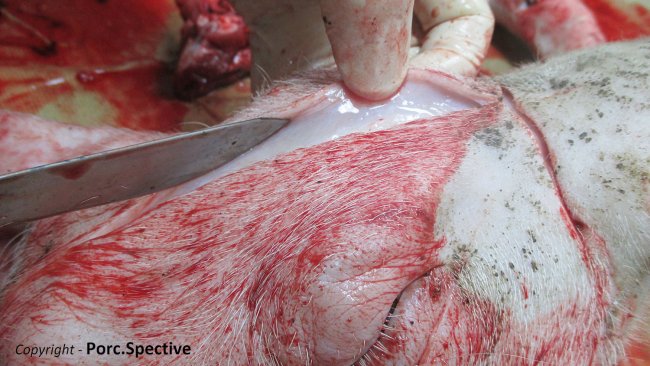 Foto 1. Edema subcutâneo da testa