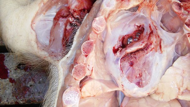 Figura 5. Pericardite.