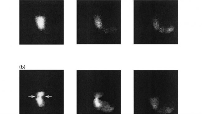 Figura 1. Imagens do esvaziamento g&aacute;strico em porcos&nbsp;alimentados com&nbsp;uma dieta baseada em&nbsp;amido (a), polpa de beterraba (b) e farelo de trigo aos&nbsp;10, 60 e 120 minutos p&oacute;s-ingest&atilde;o (Fonte: Guerin et al., 2001).
