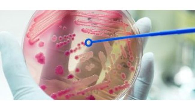 antimicrobial resistance