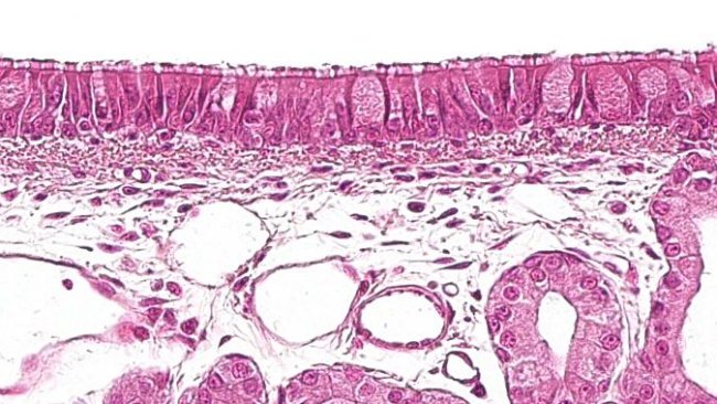 Figura 1: Epitélio pseudo-estratificado ciliado com células caliciformes característico do aparelho respiratório