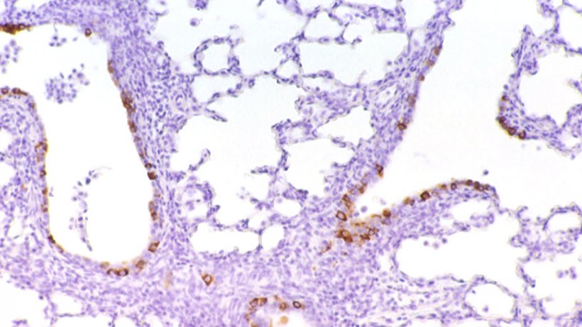 Figura 6: Células imunomarcadas contra PRCV no epitélio bronquiolar
