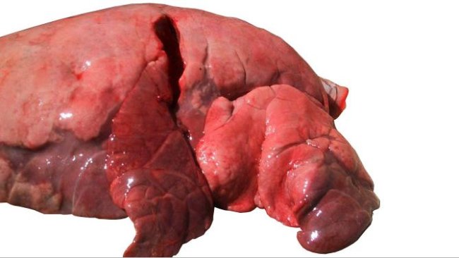 Figura 4: Lóbulos craneal e medial afectados por uma pneumonia broncointersticial causada por SIV
