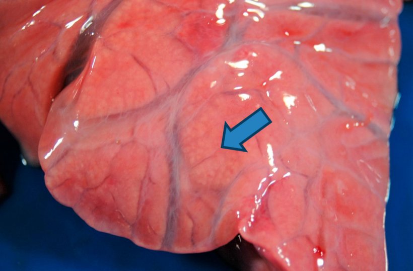 Figura 4: Broncopneumonia purulenta: ampliação da consolidação craneoventral onde se observam pequenas áreas de cor branco-amarelado (seta) que correspondem aos alvéolos pulmonares cheios de material purulento. Também se aprecia edema intersticial.