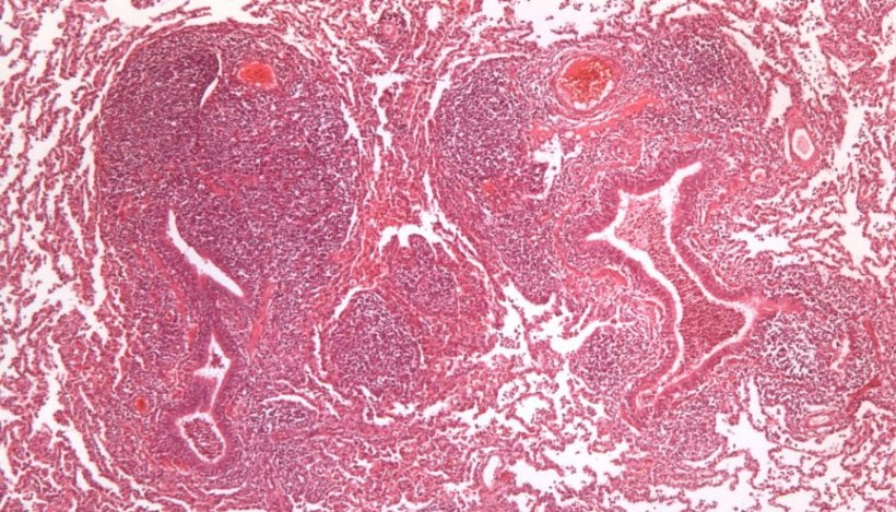 Figura 2: Hiperplasia do tecido linfóide peribronquiolar causada por M. hyopneumoniae.
