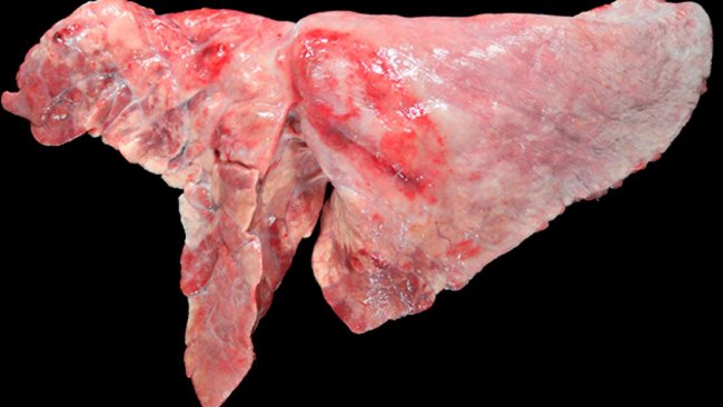 Figura 5: Pulmão de um porco co-infectado com M. hyopneumoniae y A. pleuropneumoniae. áreas de consolidação craneo-ventrais de cor castanho-avermelhadas, provocada pela infecção por M. hyopneumoniae e uma lesão ovalada com fibrose pleural e zonas hemorrágicas no lóbulo diafragmático, que corresponde 
à cronicidade de um foco de necrose produzido por A. pleuropneumoniae.