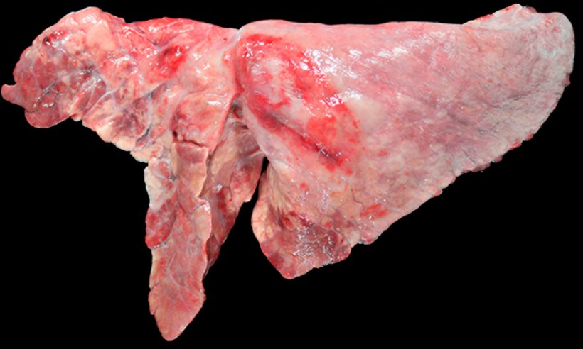Figura 5: Pulmão de um porco co-infectado com M. hyopneumoniae y A. pleuropneumoniae. áreas de consolidação craneo-ventrais de cor castanho-avermelhadas, provocada pela infecção por M. hyopneumoniae e uma lesão ovalada com fibrose pleural e zonas hemorrágicas no lóbulo diafragmático, que corresponde 
à cronicidade de um foco de necrose produzido por A. pleuropneumoniae.
