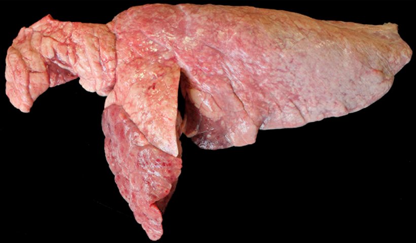 Figura 6. Pulmão de um porco co-infectado com M. hyopneumoniae e P. multocida. Áreas de consolidação craneoventrais de cor castanho-avermelhado sobre elevadas relativamente ao resto do parênquima pulmonar que correspondem a uma lesão por P. multocida. No lóbulo craneal e bordo craneoventral do lóbulo caudal observam-se áreas avermelhadas de consolidação e de aspecto deprimido, que correspondem a lesões M. hyopneumoniae.
