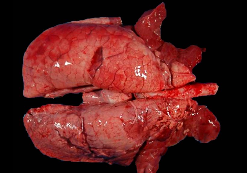Figura 4. Pulmão de um porco co-infectado com M. hyopneumoniae e SIV. Áreas de consolidação de cor vermmelha nas porções craneoventrais do pulmão e algumas outras de menor extensão nos lóbulos diafragmáticos. Nestas lesões craneoventrais co-existem as  lesões de M. hyopneumoniae e SIV, sendo impossível distingui-las macroscopicamente.
