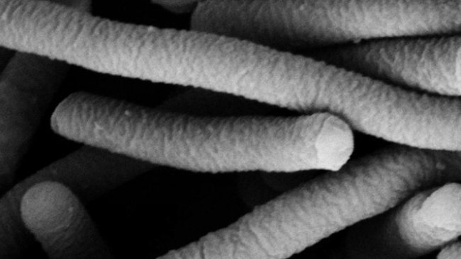 Foto 1. Micrografia electrónica de Lactobacillus acidophilus, que tem características probióticas. Foto de Mogana Das Murtey e Patchamuthu Ramasamy.