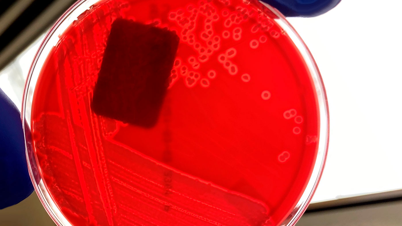 <p>Figura 1. Cultivo puro de <em>E. coli</em> hemolítica em agar sangue. A zona clara em volta de cada colónia bacteriana indica hemólise (descomposição do sangue na placa de agar). Fonte: Universidade Estatal de Iowa, Laboratório de Diagnóstico Veterinário, Secção de Bacteriologia.</p>