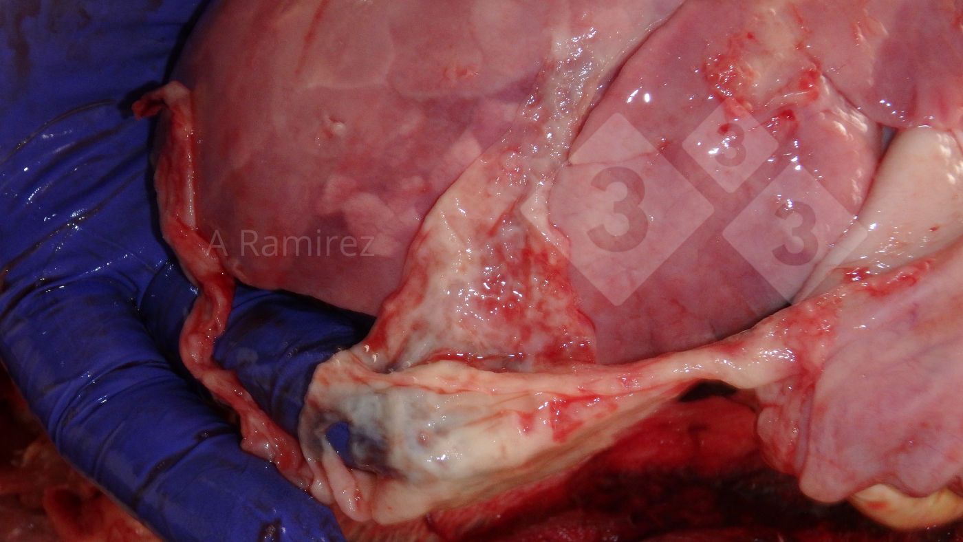 <p>Figura 2: Foto de un exudado fibrinoso/fibroso en la superficie del pulm&oacute;n. La&nbsp;fibrina y el par&eacute;nquima pulmonar&nbsp;son muestras para recoger en el diagn&oacute;stico de<em>&nbsp;G. parasuis</em>.</p>
