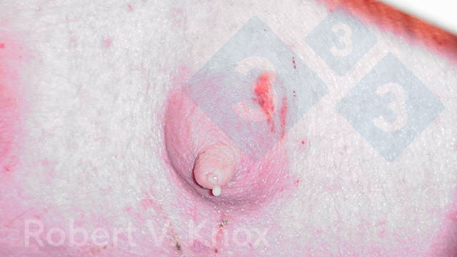 <p>Imagem 2. Calostro a gotejar da glândula mamária</p>