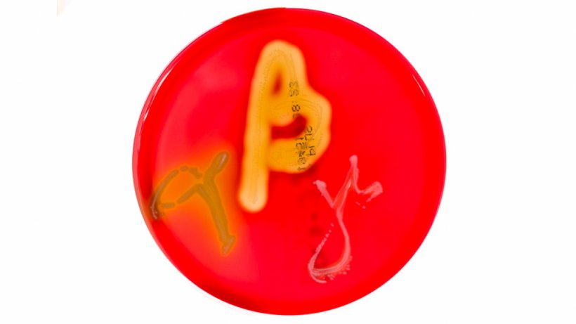 Figura&nbsp;1. Culturas em placas de Petri em ágar sangue mostrando hemólise alfa, beta e gama. Fonte:&nbsp;Mibilehr https://creativecommons.org/licenses/by-sa/4.0/deed.ene&nbsp;