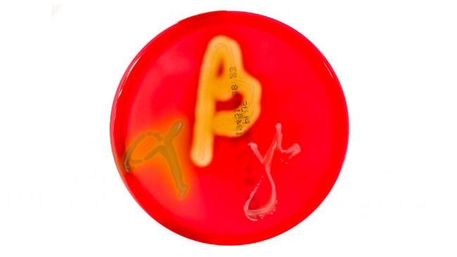 Figura&nbsp;1. Culturas em placas de Petri em ágar sangue mostrando hemólise alfa, beta e gama. Fonte:&nbsp;Mibilehr https://creativecommons.org/licenses/by-sa/4.0/deed.ene&nbsp;