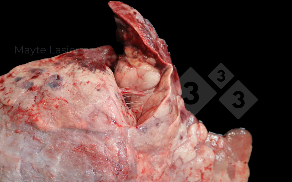 <p>Pleurite cranial</p>
