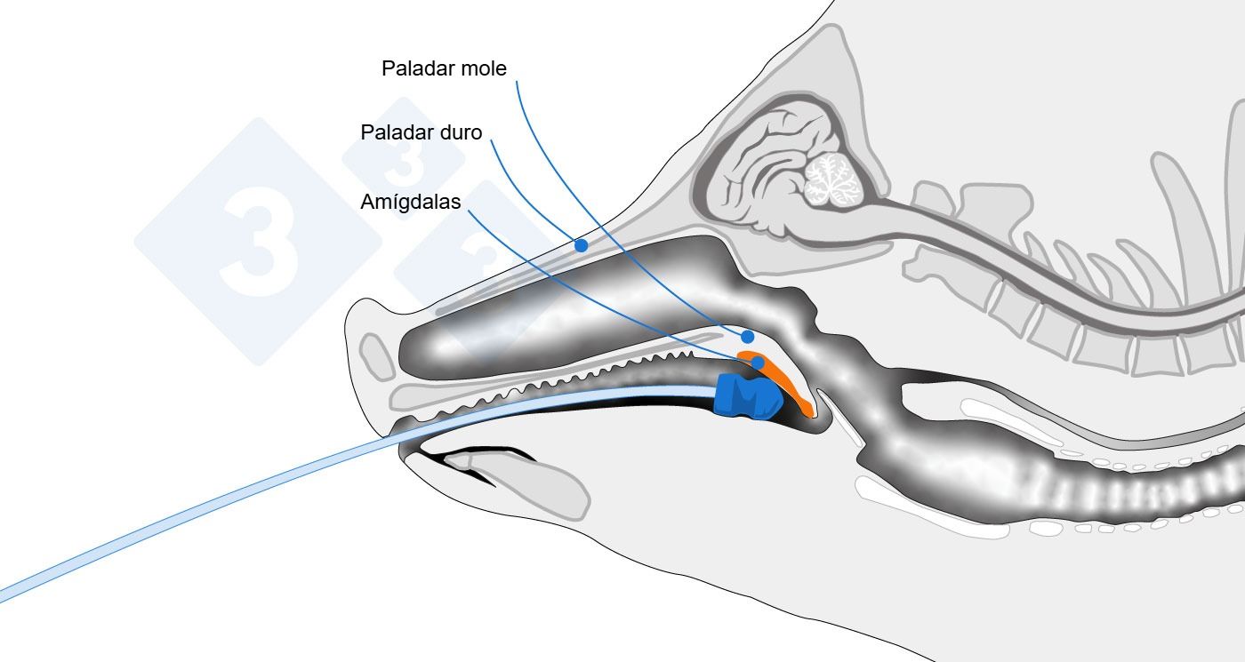 Esquema anatomico señalando el punto de toma de muestra