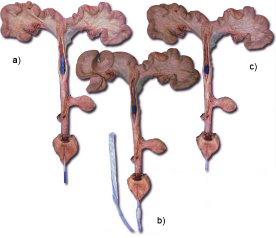 aparelho genital porca