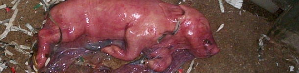 Monitorización de partos: Sistemas de control