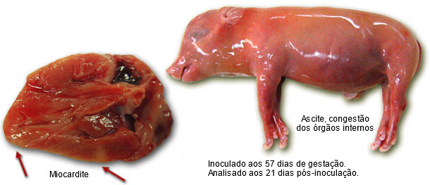 Miocarditis y ascitis