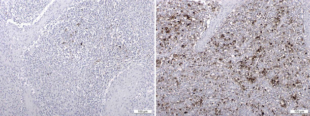 Antígenos de PCV2 detectados por inmunohistoquímica