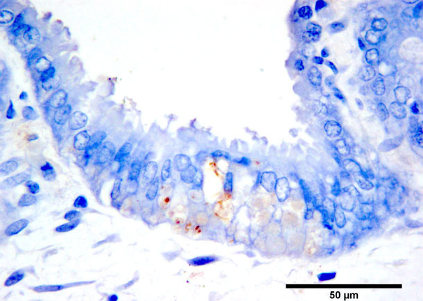 Tinción marrón por inmunohistoquímica del antígeno de PCV2b en trofoblastos marrones. Cromógeno diaminobenzidina y contraste de hematoxilina.