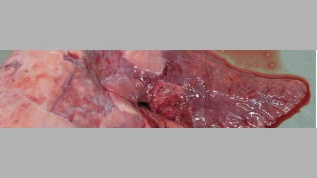 Lesión pulmonar por M hyo