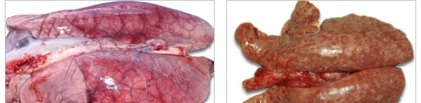 Pulmones