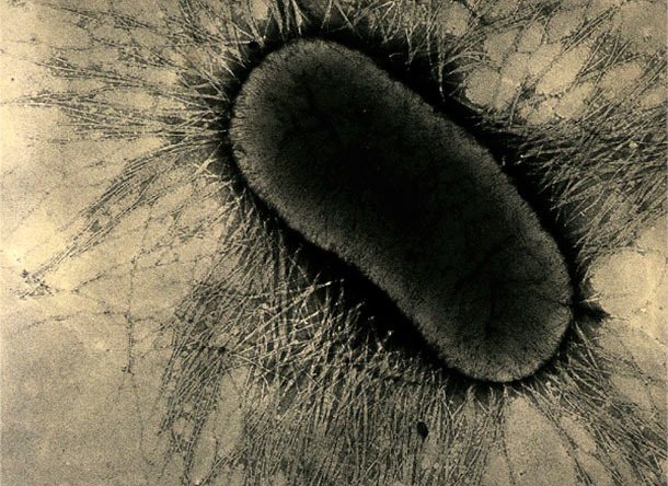 Los factores de adhesión de ETEC son proteínas especializadas de las fimbrias o pilus, que se adhieren fuertemente a los receptores de glicoproteína de las células intestinales