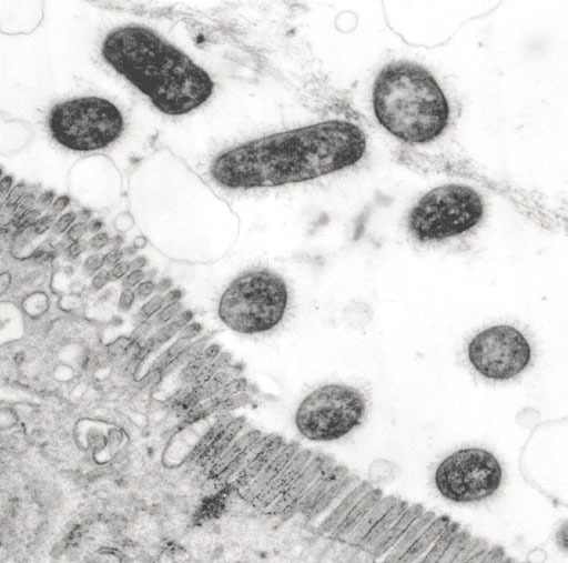 Bactéria ETEC produzendo adesinas fimbriais similares a pêlos na sua superfície e aderindo a células epiteliais intestinais num porco com diarreia, mediante microscopía de electrões