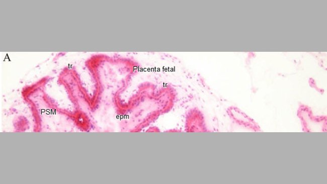 Histopatología en endometrio y planceta
