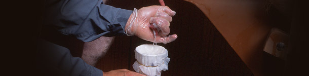 Extracción de semen