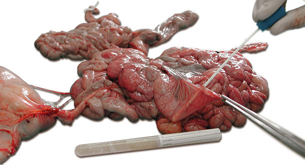 Toma de muestra con hisopo de los tramos de intestino afectado