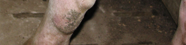 Miembro posterior de una nulípara