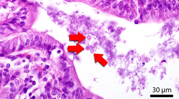 Sección histológica del colon. Las flechas rojas indican Blastocystis en el lumen intestinal