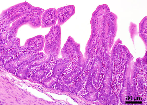 Sección histológica del intestino delgado. En la mucosa se localizaron varios granulocitos eosinofílicos.