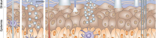 Inmunizaci&oacute;n por v&iacute;a cut&aacute;nea