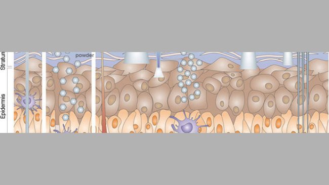 Inmunización por vía cutánea