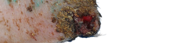 Ulceración, formación de costras y engrosamiento de la epidermis