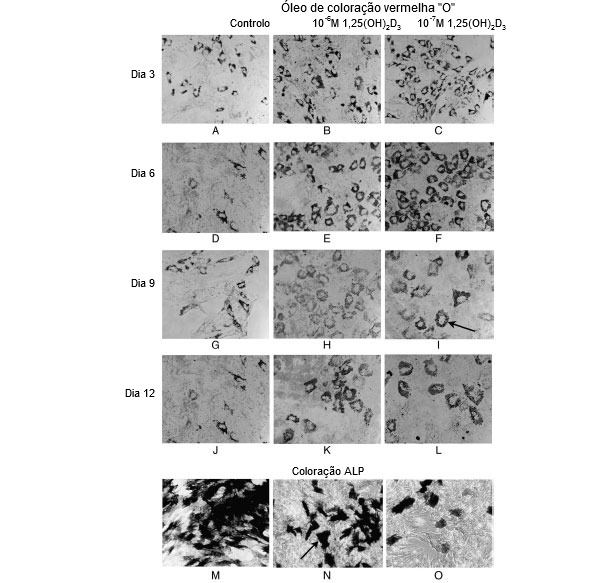 Óleo de coloração vermelha 'O' para lípidos neutros em células adiposas e coloração de Fosfatasa Alcalina (ALP) em células tipo osteoblasto