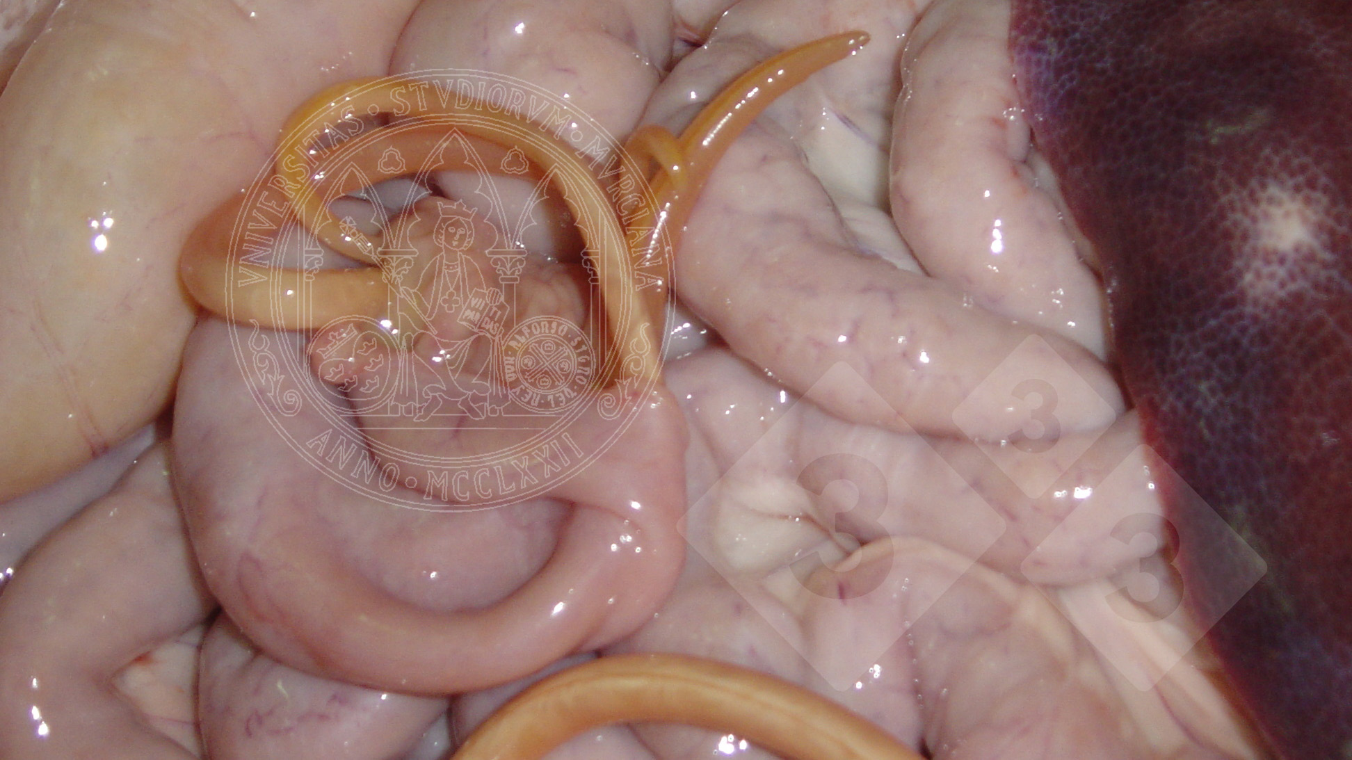 parazitozele intestinale)