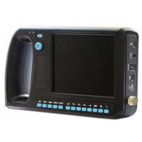Ecógrafo AV-3000BF Ecógrafo AV-3000BF